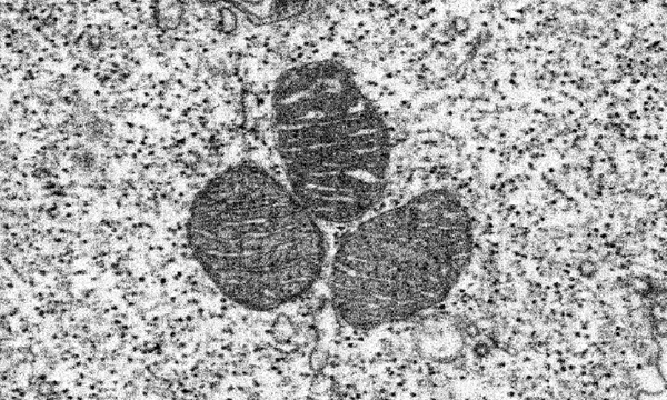 Digest №17: Mitochondrial Energy Generation and the Consequences of Its Aberration in Cancer