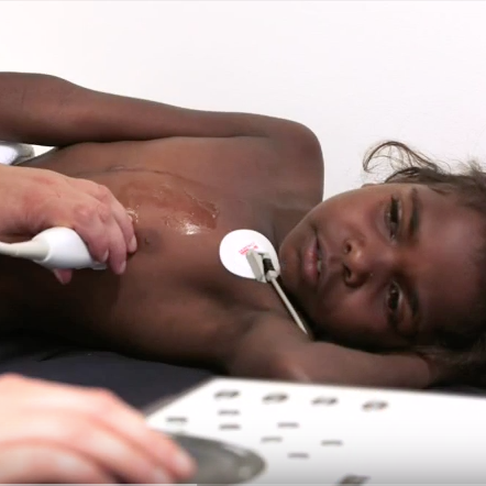 Rheumatic fever rife in indigenous communities as nation-wide rates spike