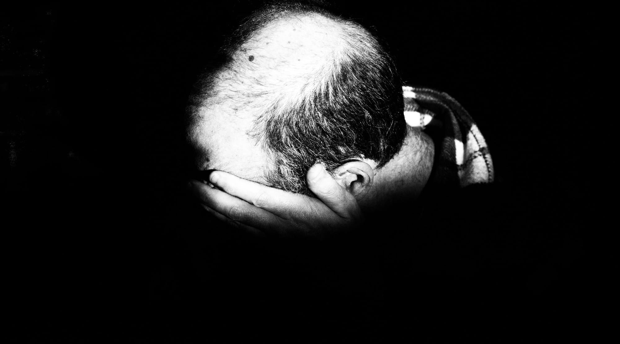To thin or try to win? Untold distress as young men battle hair loss