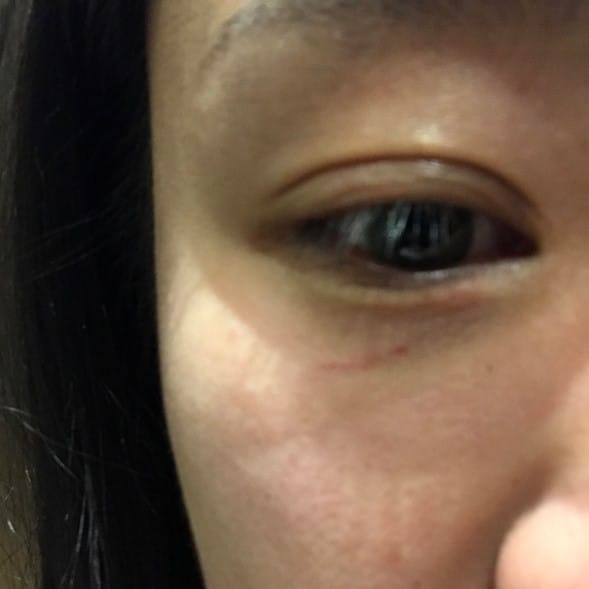 International student injured during racial attack