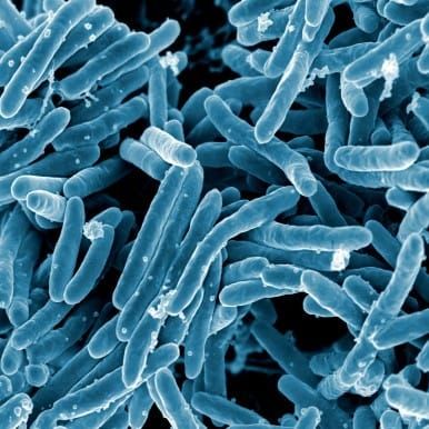Urgent answers needed on tuberculosis, experts say post image