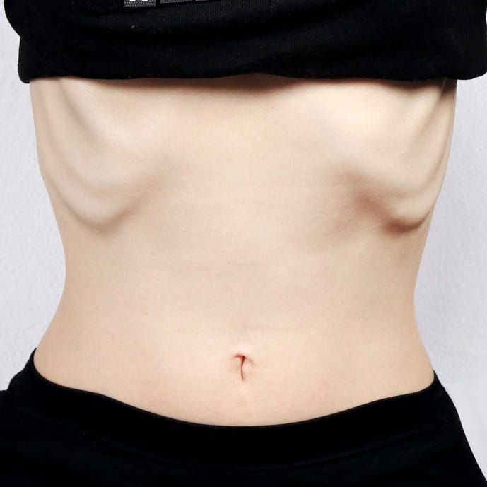 Super-skinny fashion laws a step in the right direction, but not enough post image