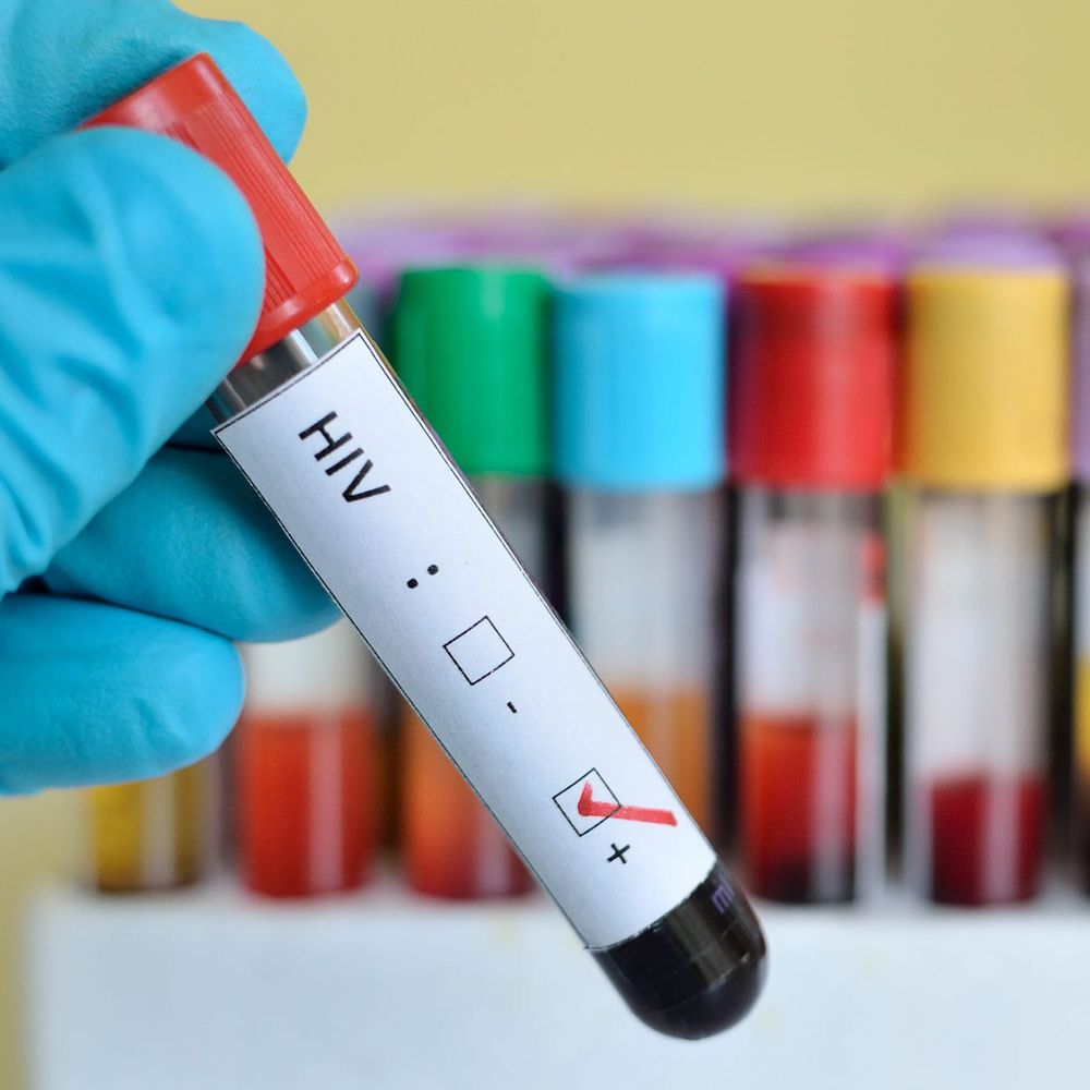 An end to AIDS in Australia post image