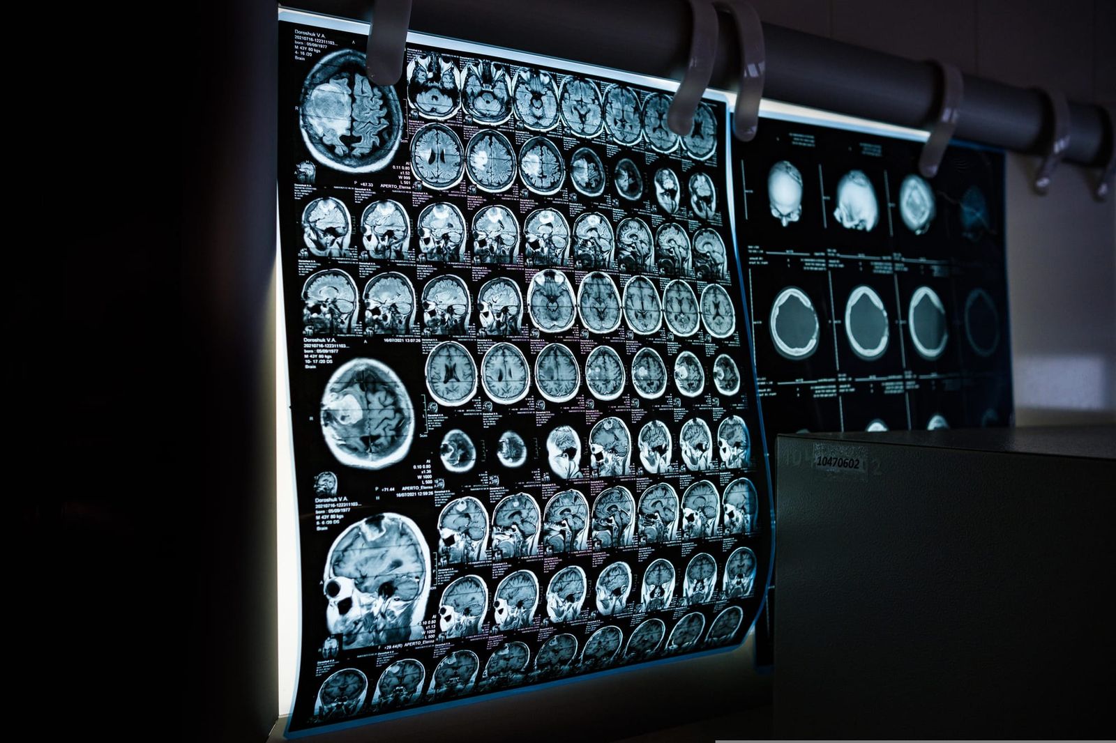 Machine mind in medicine: The boons and banes of AI in healthcare post image