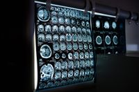 Machine mind in medicine: The boons and banes of AI in healthcare post image