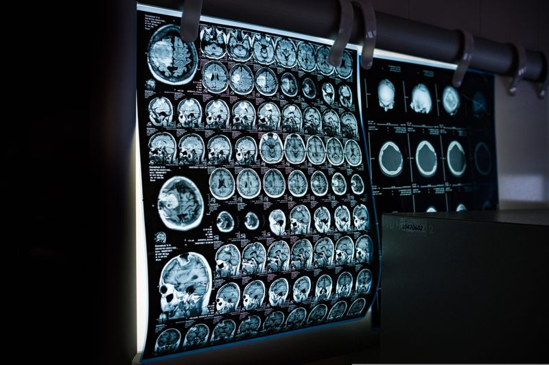 Machine mind in medicine: The boons and banes of AI in healthcare post image