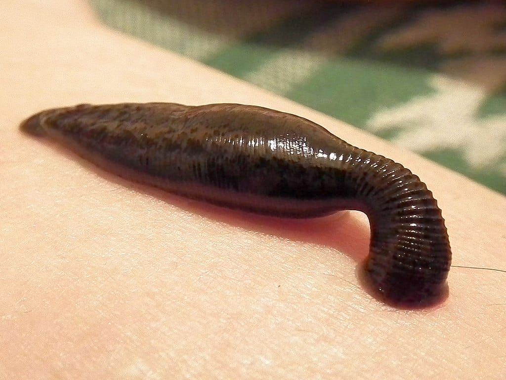 Photo of a leech attached to human skin