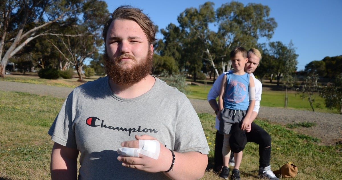 Dog act: Owner walks away after vicious attack at Homburg Park