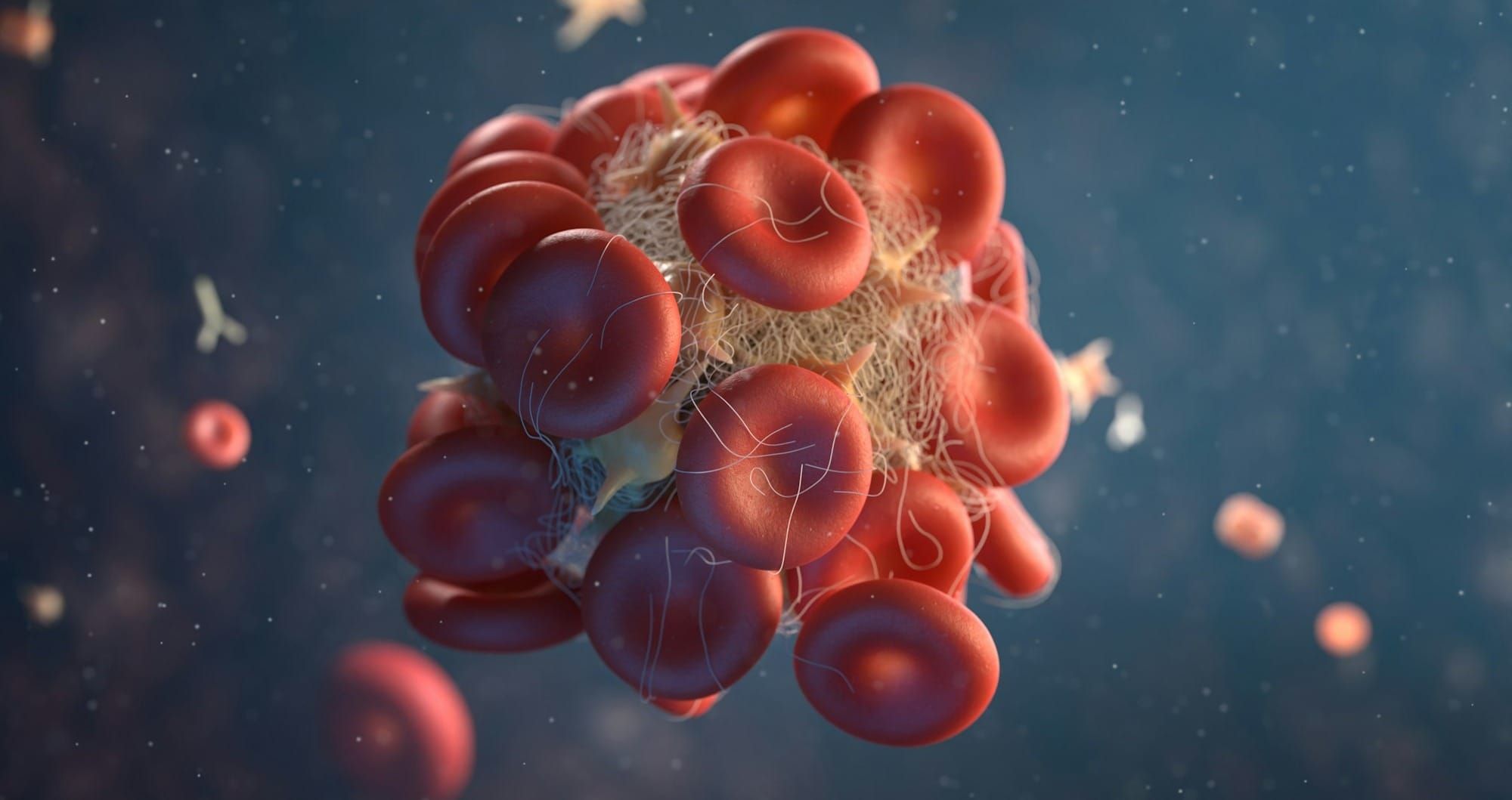 DOACs for Venous Thromboembolism: Which is the Best?