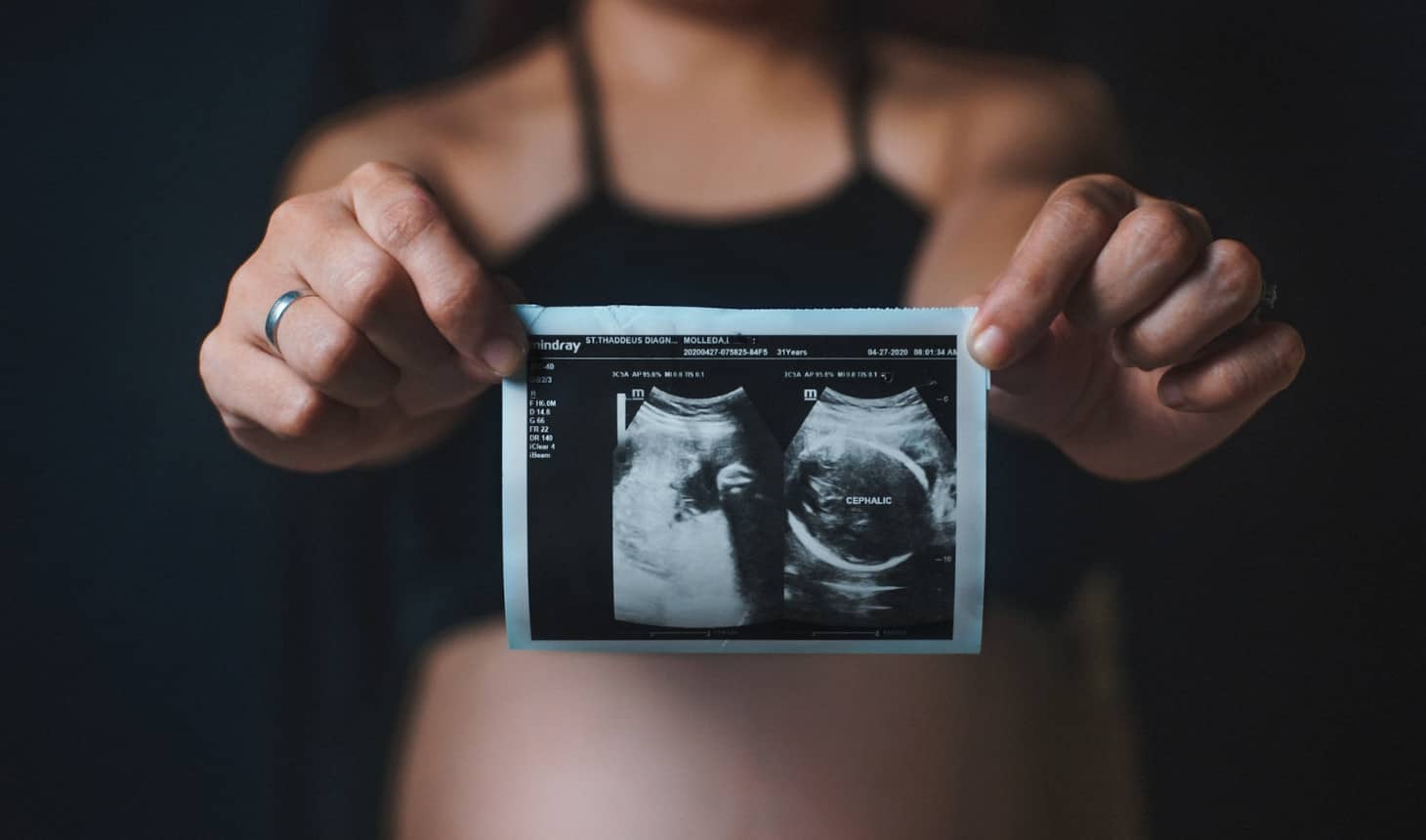 embarazada mostrando una ecografía