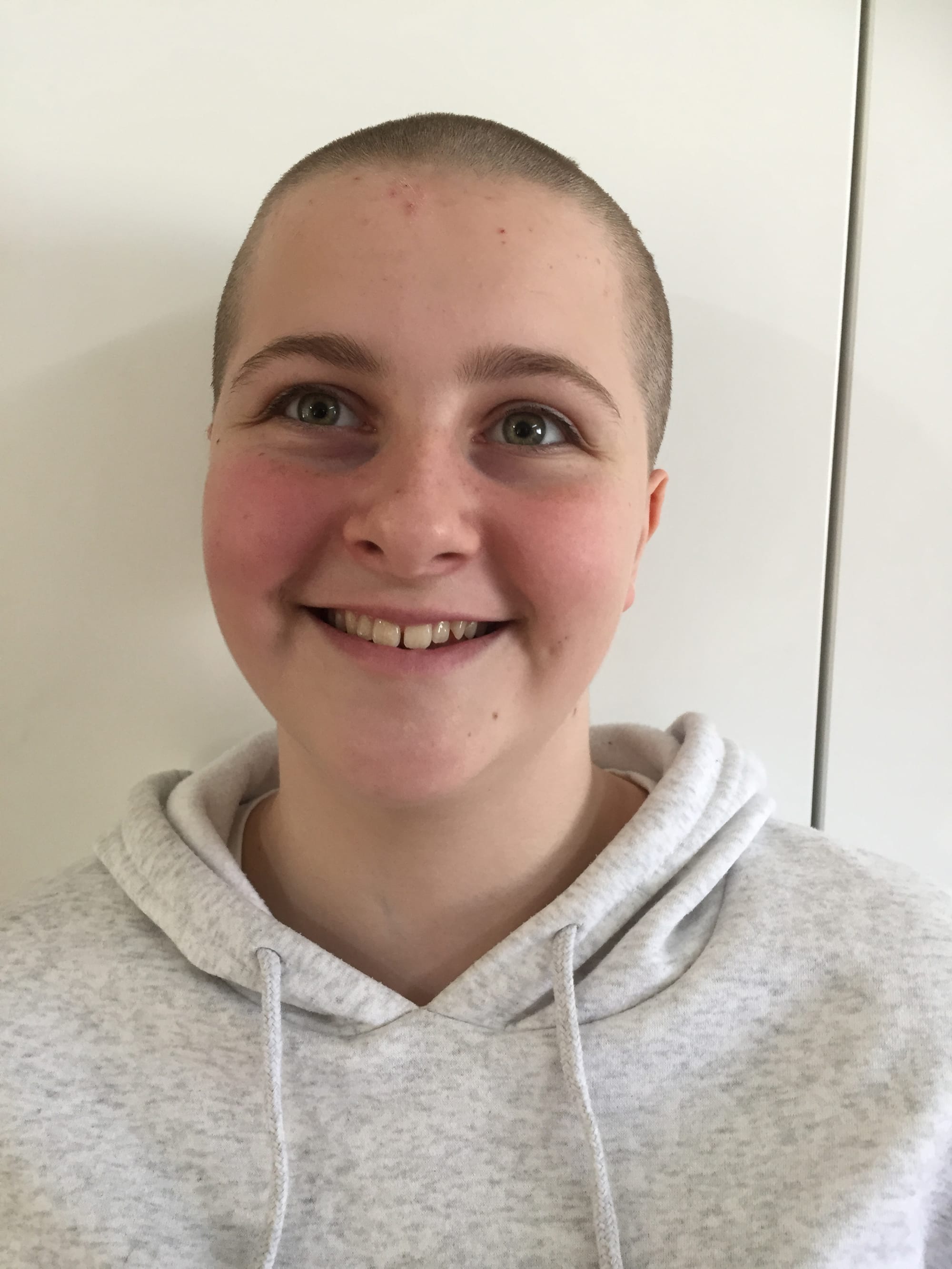 Claire shaves her head to raise funds for cancer research
