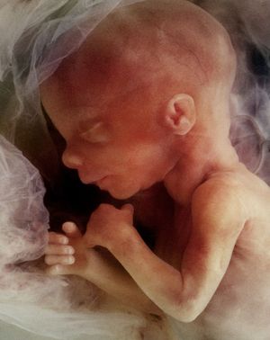 The extreme ideology of abortion