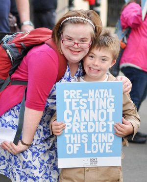 Down’s syndrome test has led to sharp drop in birth rates