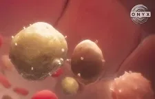 How India is leading a cancer revolution