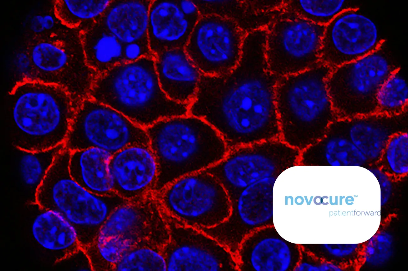 FDA approves Novocure’s Optune Pax for locally advanced pancreatic cancer