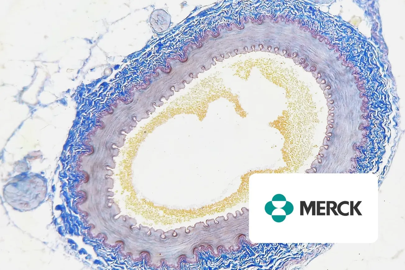 Stained cross-section of an artery under a microscope