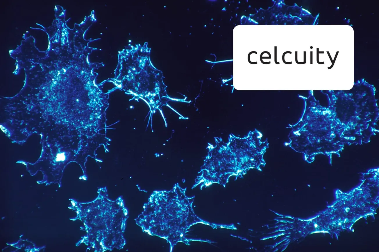Cancer cells under a fluorescence microscope