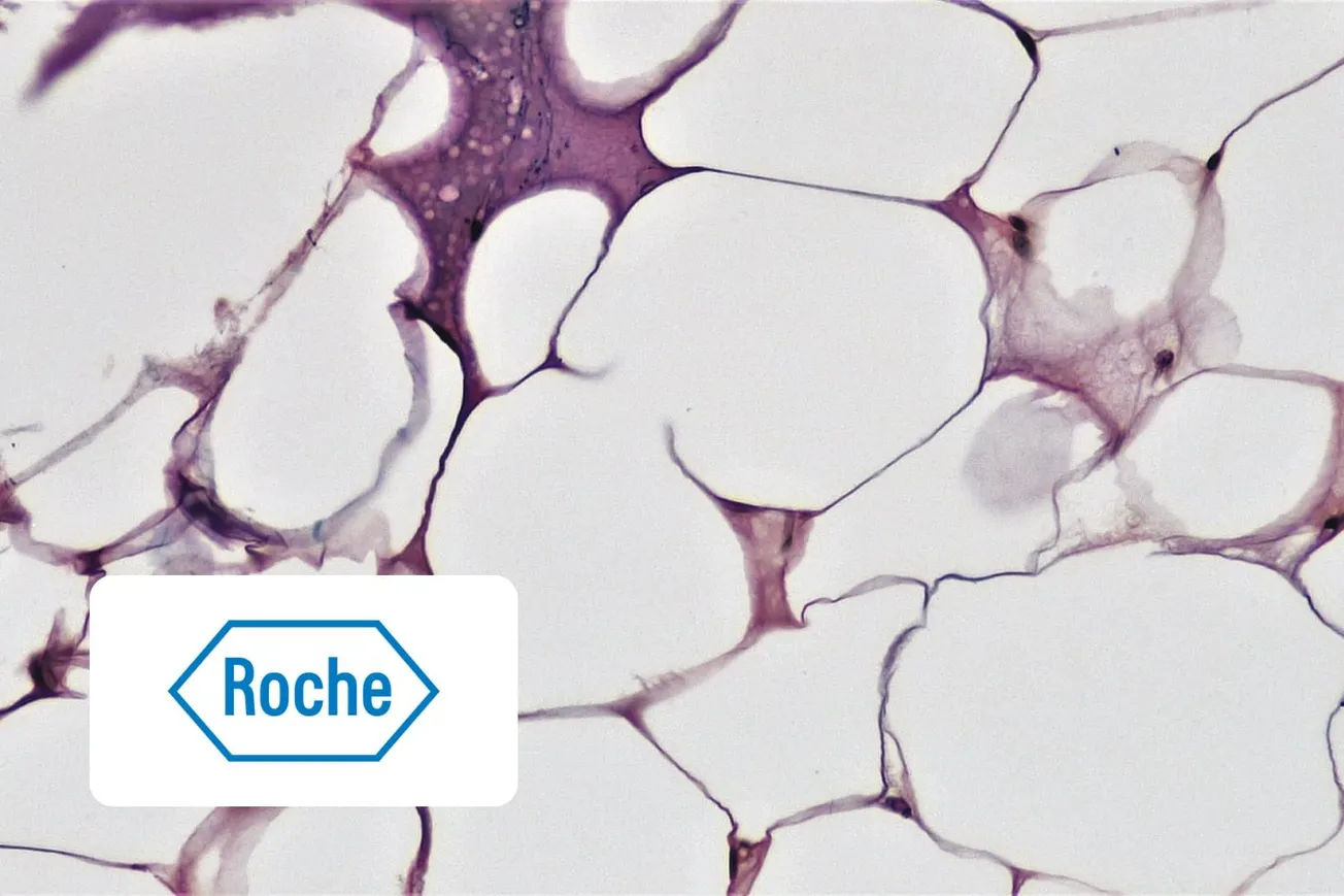 Adipose tissue (fat cells) under a microscope