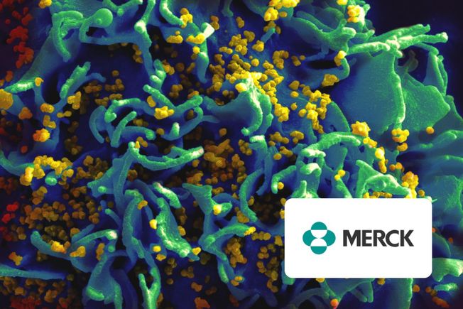 Scanning electron micrograph of HIV particles on a T cell