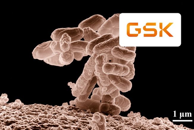 Scanning electron micrograph of E. coli bacteria