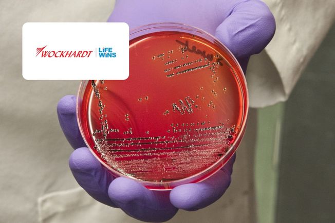 A gloved hand holding a petri dish of bacterial colonies