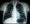 A chest X-ray showing lung tissue