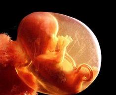 Cordão Umbilical