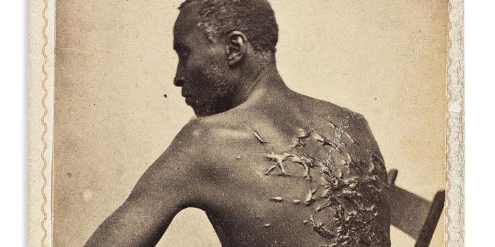 The scarred back of escaped slave Peter Gordon in Louisiana, 1863