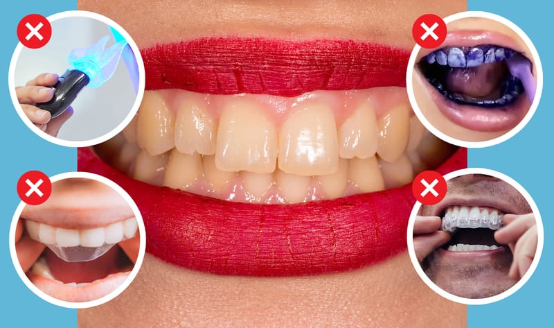 Other bad forms of teeth whitening