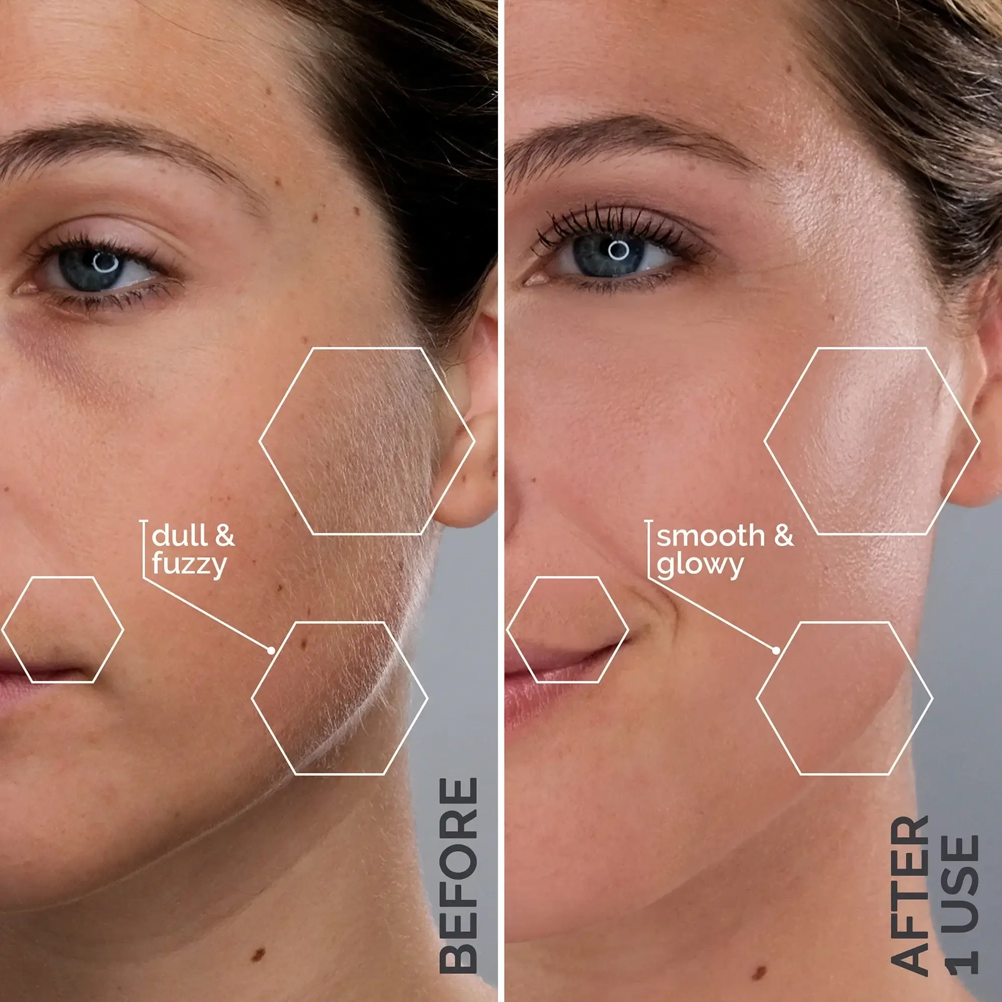 A before and after of the dull skin with peach fuzz and then after with smooth and glowy skin