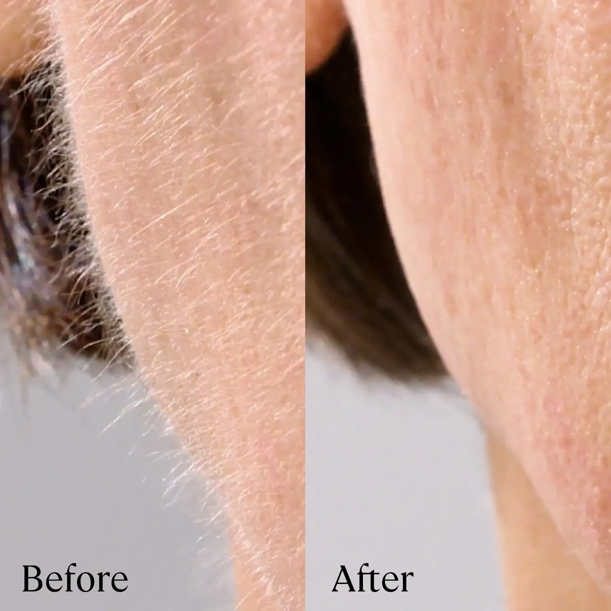 A close up image of the skin with and without peach fuzz