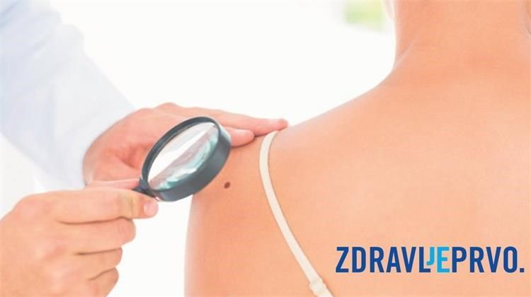 Nastavlja se javnozdravstvena akcija ranog otkrivanja melanoma na hrvatskim otocima