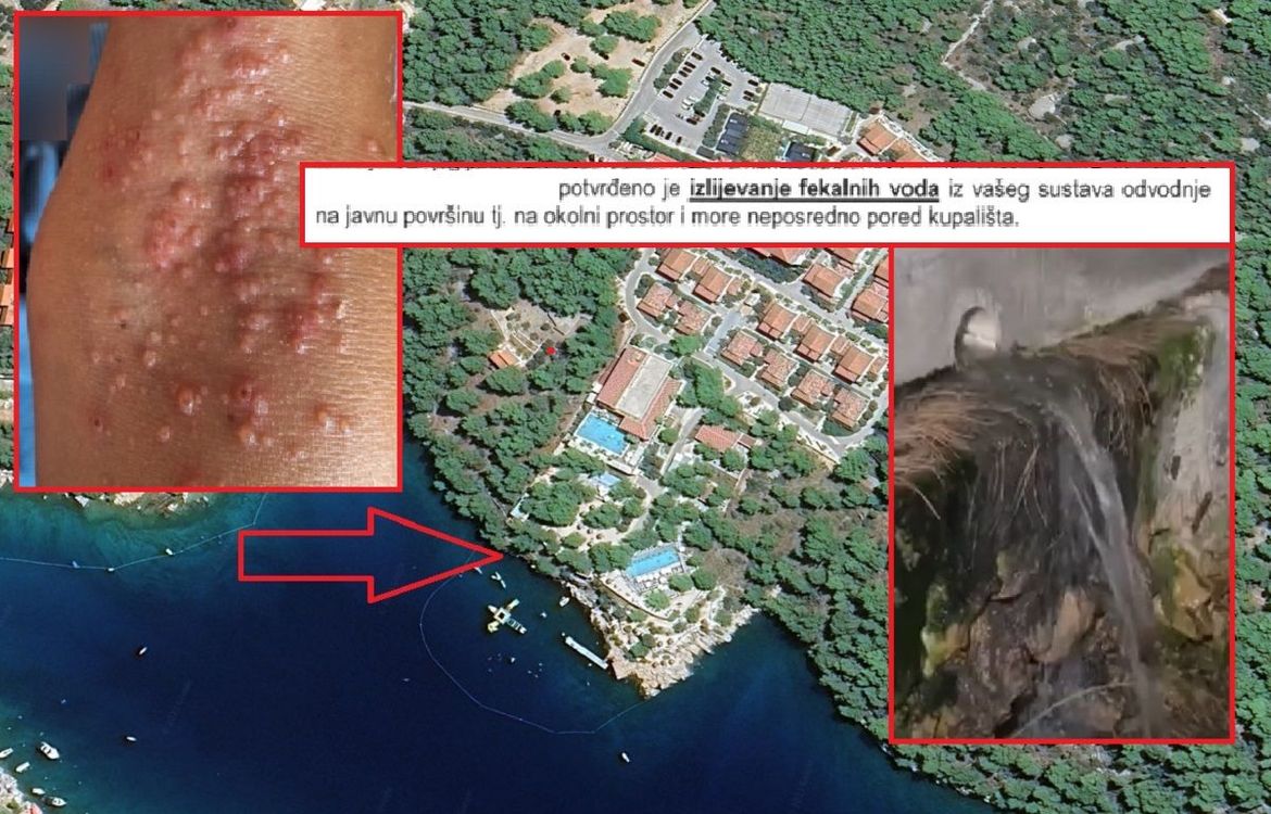 ALARM NA BRAČU! Hotel  ispušta fekalije u more, djeca dobila kožna oboljenja - Vodovod: "Zatvorit ćemo vam vodu!"