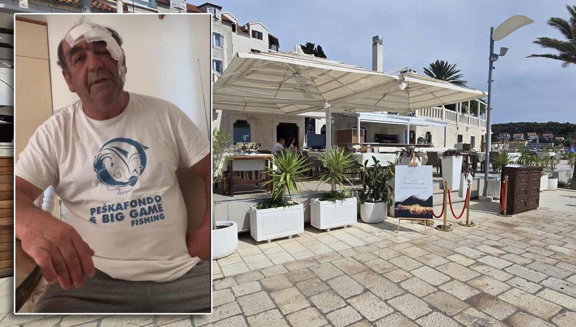 DORH zaprimio kaznenu prijavu zbog napada na vlasnika restorana i kuhara iz hvarskog restorana, oglasili se iz Carpe Diema s isprikom, a javio se i ozlijeđeni kuhar