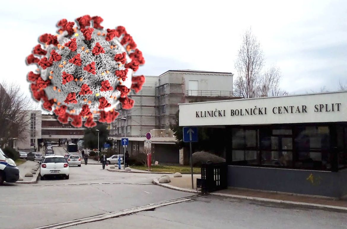 KBC Split traži 70 medicinskih sestara, javilo se samo 14
