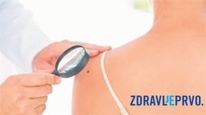 Nastavlja se javnozdravstvena akcija ranog otkrivanja melanoma na hrvatskim otocima