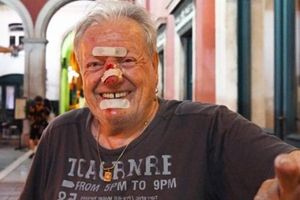 Ibrica Jusić pao na Porokurativama - zadobio lakše ozljede!