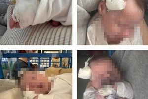 MALENI HEROJ Majka s Brača u šoku: "Liječnik je moju bebu od 22 dana s temperaturom preko 40 poslao kući uz poruku kako je sve u redu, a onda je u Splitu  otkriveno da ima sepsu!"