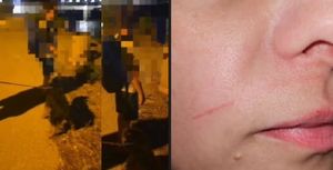 JEZA NA ČIOVU Netko rasteže ribolovni najlon kao zamku za motocikliste: "Ljudi bi mogli poginuti!"