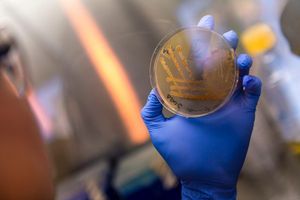 VELIKO OTKRIĆE Dubokomorska bakterija može izliječiti tumor na mozgu?