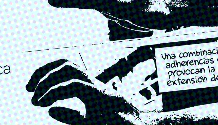 Patología neurológica, traumática y reumatológica de la mano.