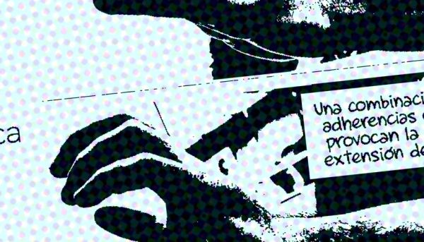 Patología neurológica, traumática y reumatológica de la mano.