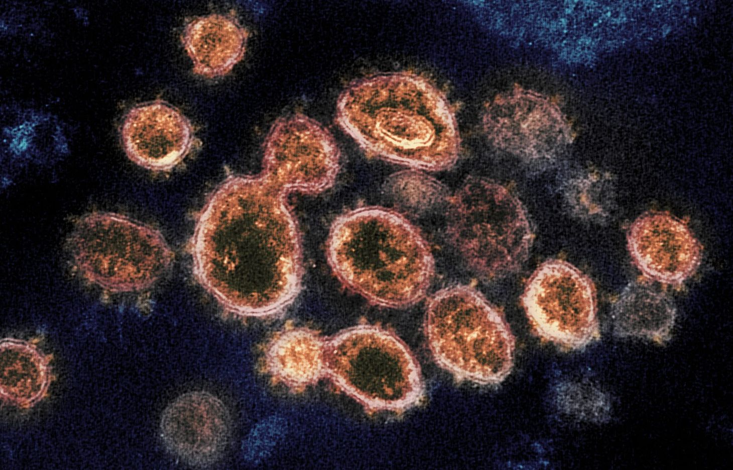 Political opportunism is dragging out the pandemic and state's fiscal uncertainty