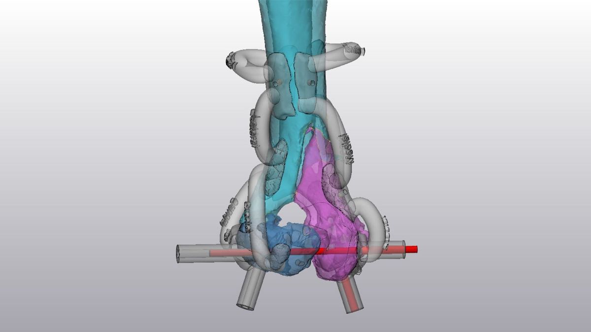 No room for guesswork: Bambu Lab H2D in service of veterinary orthopedic surgery