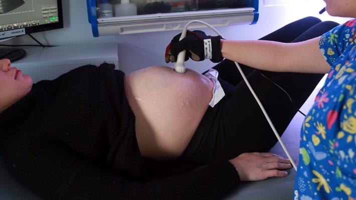 EL PROYECTO QUE DESNUDA EL MIEDO DE LA IZQUIERDA A LA VERDAD DEL ABORTO post image