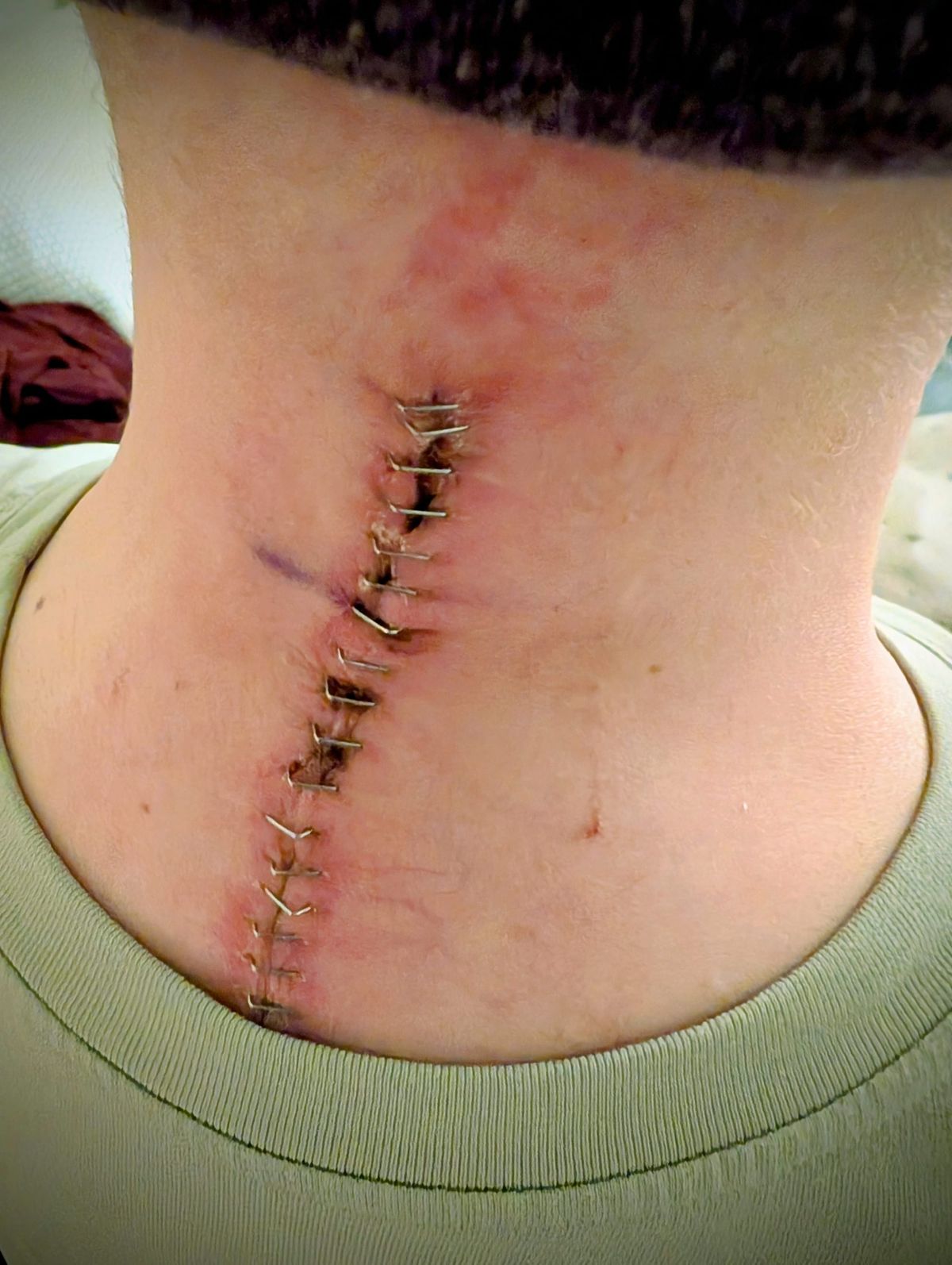 Chemo Today