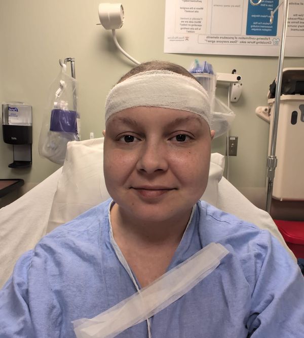 Post Surgery Update