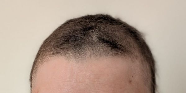 Hair