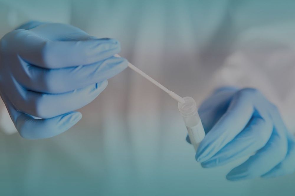 New COVID-19 PCR procedures for close contacts