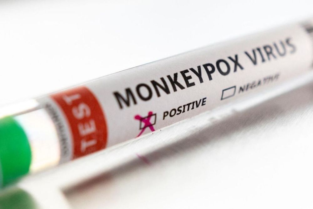 High-risk contacts of Monkeypox in UK told to isolate for 21 days